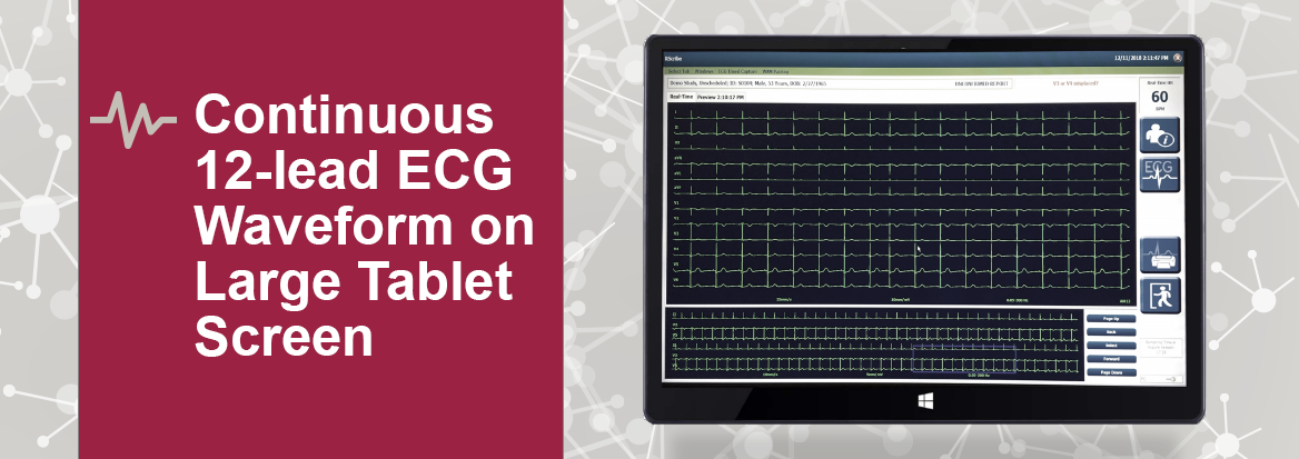 ESource-ECGproductpage ESource-ECGproductpage