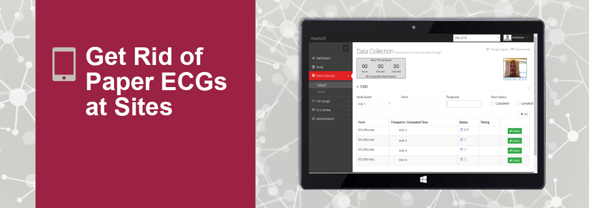 ESource-ECGproductpage ESource-ECGproductpage